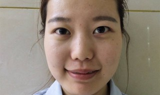 怎样提升面部肌肤 提升面部肌肤的方法