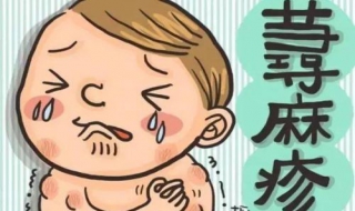湿疹与荨麻疹的区别 湿疹与荨麻疹的区别在哪里