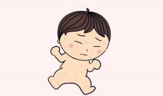 头上痱子怎么快速消除 婴儿头上痱子怎么快速消除