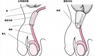 氙气的症状是什么 氙气有哪些治疗方法